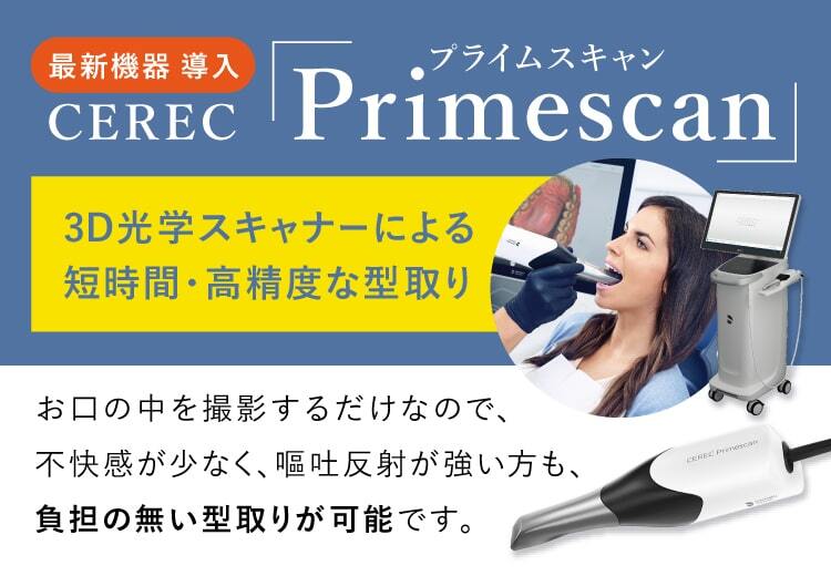 primescan_SP